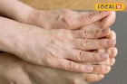 थंडीमुळे हात-पाय सुजतात? वेदना आणि सूज त्वरित दूर करतील हे सोपे घरगुती उपाय!