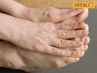 थंडीमुळे हात-पाय सुजतात? वेदना आणि सूज त्वरित दूर करतील हे सोपे घरगुती उपाय!