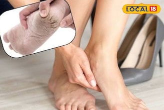 भेगा आणि वेदना घालवून टाचांना मऊ करेल हा सोपा उपाय! काही मिनिटांत दिसेल फरक..