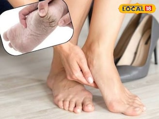 भेगा आणि वेदना घालवून टाचांना मऊ करेल हा सोपा उपाय! काही मिनिटांत दिसेल फरक..