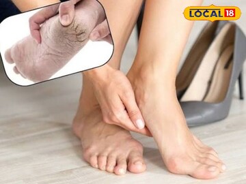 भेगा आणि वेदना घालवून टाचांना मऊ करेल हा सोपा उपाय! काही मिनिटांत दिसेल फरक..