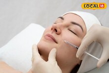 Cosmetic Surgery : तरुणींमध्ये झपाट्याने वाढतोय कॉस्मेटिक सर्जरीचा ट्रेंड, परफेक्ट करत आहेत लाखोंचा खर्च!