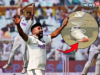 Mohammed Siraj Torn Shoes
