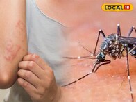 ...नाहीतर चालतानाही कळवळाल! चिकनगुनियाच्या लक्षणांकडे अजिबात करू नका दुर्लक्ष