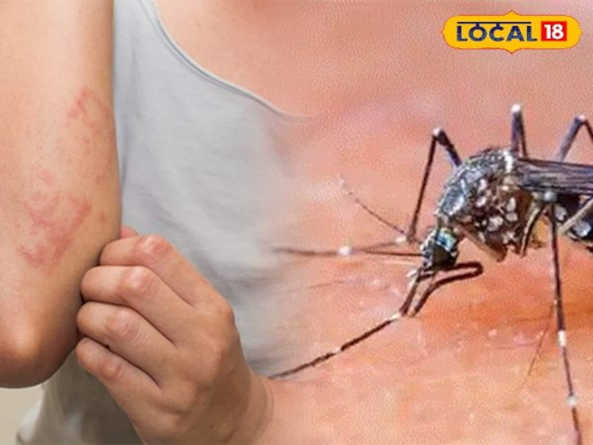 ...नाहीतर चालतानाही कळवळाल! चिकनगुनियाच्या लक्षणांकडे अजिबात करू नका दुर्लक्ष