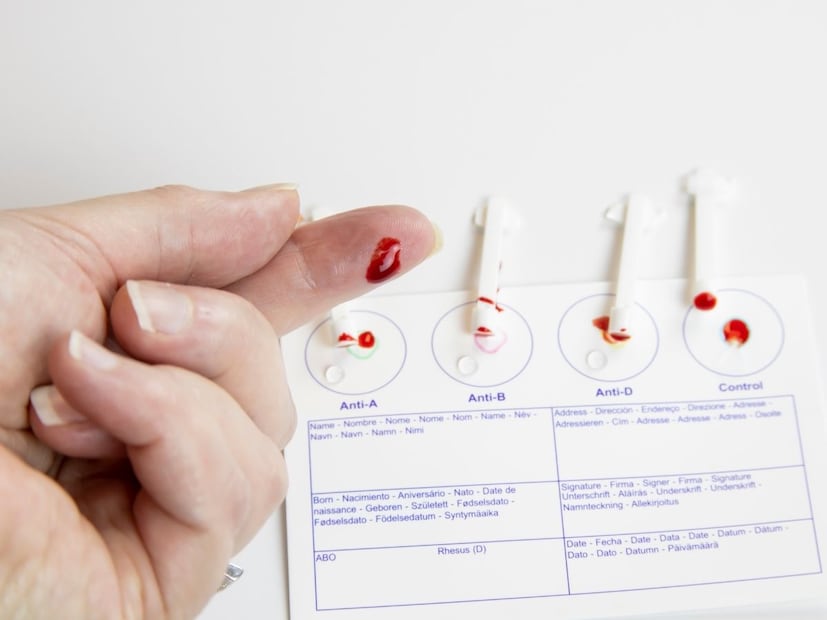 त्याने अशी स्ट्रिप तयार केली आहे जी महिलांना कॅन्सरपासून वाचवू शकते. माहितीनुसार भारतात दरवर्षी जवळपास 77000 महिलांचा सर्व्हिकल कॅन्सरमुळे मृत्यू होतो. तरी सध्याच्या कॅन्सरचं निदान करणाऱ्या टेस्ट अशा आहेत की बहुतेक जण त्या करतच नाही.