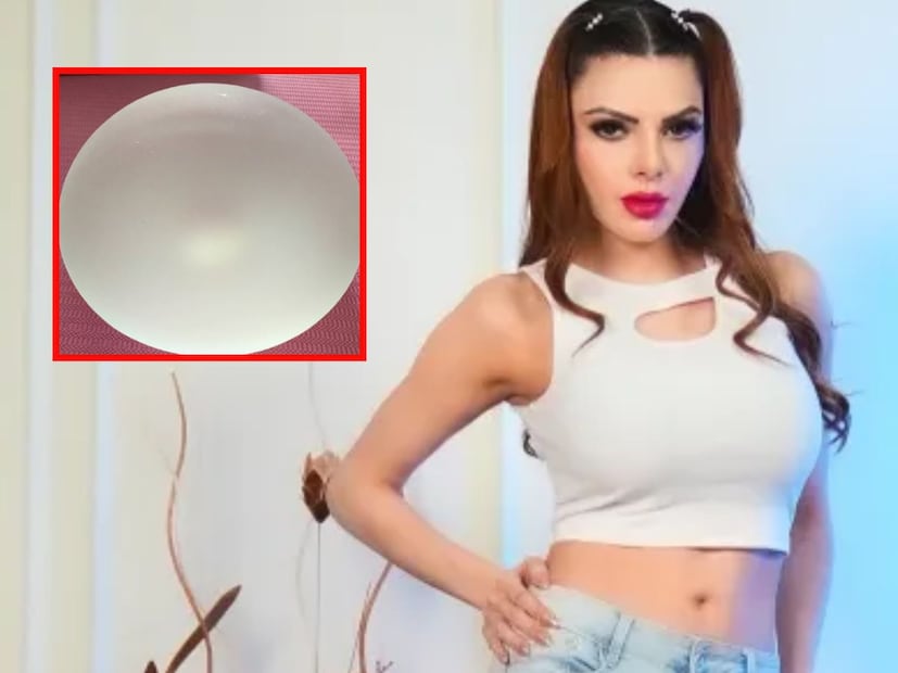  शर्लिनला काही दिवसांपासून पाठ, छाती आणि मानदुखीचा भयंकर त्रास होत होता. आता तिने हेव्ही ब्रेस्ट इम्प्लांट काढून टाकले आहेत. नुकतीच तिची शस्त्रक्रिया पार पडली असून अभिनेत्री सुखरुप आहे.