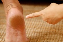 Winter Care : हिवाळ्यात अशी घ्या हातापायांची काळजी, भेगा घालवण्यासाठी घरी बनवा पेट्रोलियम जेली