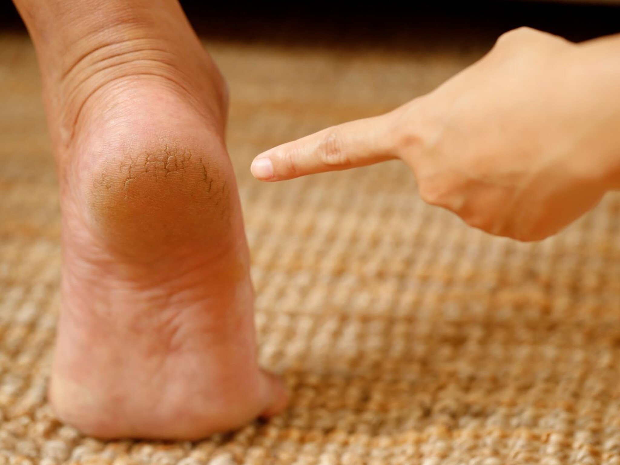 Winter Care : हिवाळ्यात अशी घ्या हातापायांची काळजी, भेगा घालवण्यासाठी घरी बनवा पेट्रोलियम जेली