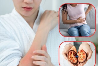 त्वचेत होणारे 'हे' बदल असतात धोक्याचे संकेत! दुर्लक्ष कराल तर किडनी गमावून बसाल