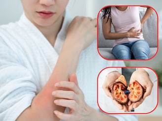 त्वचेत होणारे 'हे' बदल असतात धोक्याचे संकेत! दुर्लक्ष कराल तर किडनी गमावून बसाल