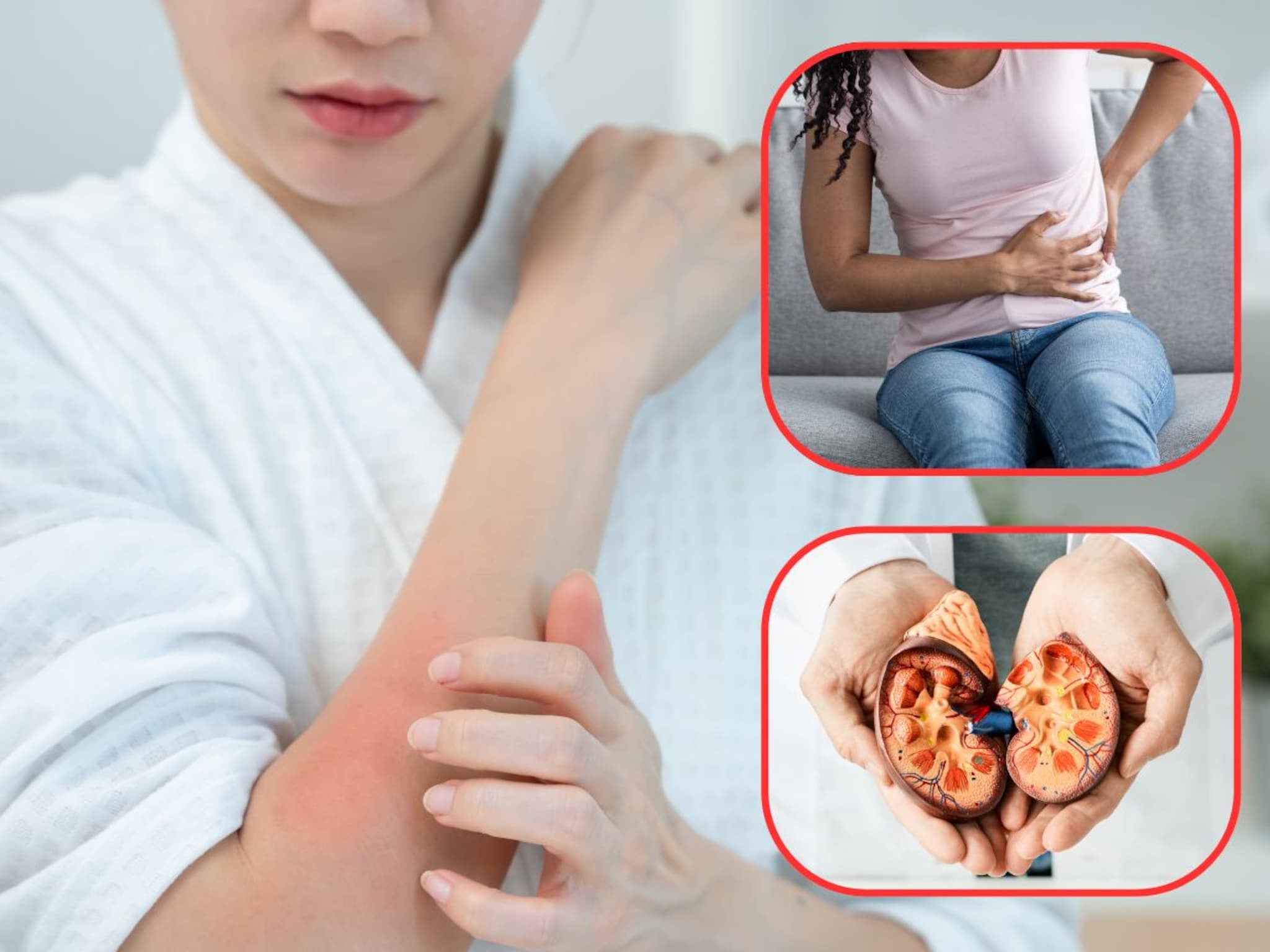 Kidney Damage : त्वचेत होणारे 'हे' बदल असतात धोक्याचे संकेत! दुर्लक्ष टाळा, नाहीतर गमावून बसाल किडनी..