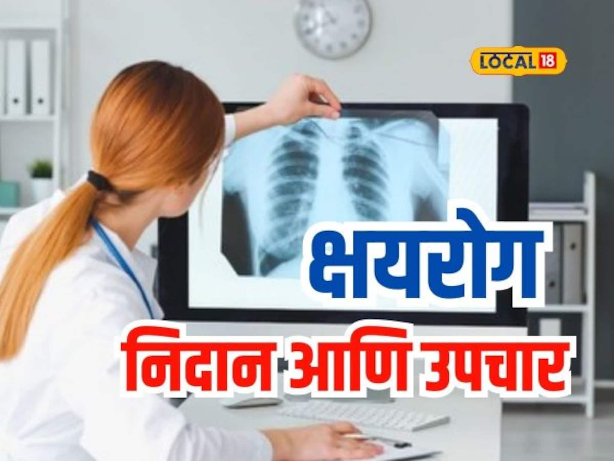 दुर्लक्ष बेतू शकतं जीवावर, ही लक्षणे असतील तर त्वरीत करा 'टीबी'ची चाचणी, Video