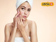 चेहऱ्यावर पिंपल्स आले असतील तर चुकूनही करू नका या तीन गोष्टी, नाहीतर होईल मोठे नुकसान