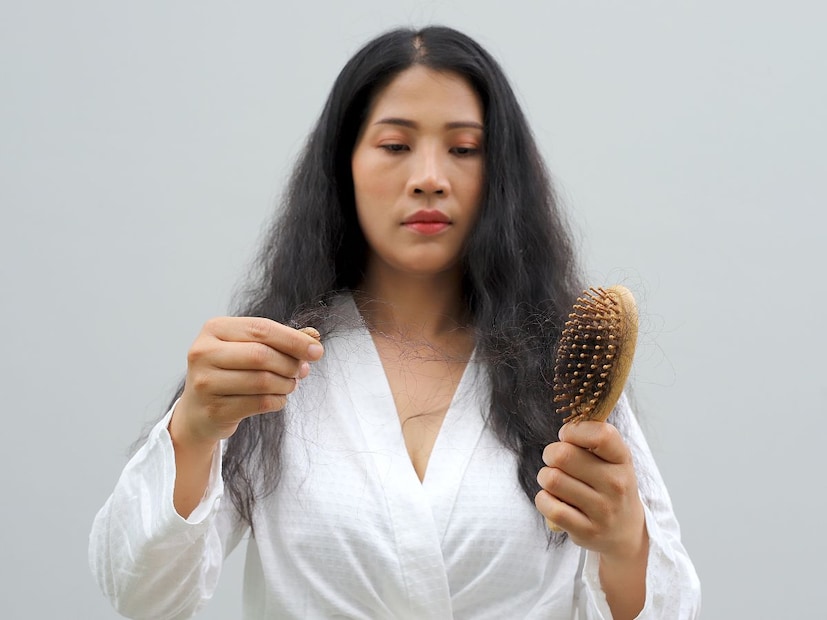 टक्कल पडण्यामागचं मुख्य कारण: बायोटिनची कमतरताकेसांच्या आरोग्यासाठी अत्यंत महत्त्वाच्या जीवनसत्त्वांपैकी एक म्हणजे बायोटिन (Biotin), ज्याला व्हिटॅमिन बी7 (Vitamin B7) असेही म्हणतात. miiskin.com या प्रतिष्ठित वेबसाइटवर प्रसिद्ध झालेल्या अहवालानुसार, बायोटिन हे शरीरातील केराटिन (Keratin) नावाच्या प्रथिनाच्या निर्मितीसाठी आवश्यक असते. केराटिन हेच प्रथिन आपले केस, नखे आणि त्वचेला मजबूत आणि निरोगी ठेवते.