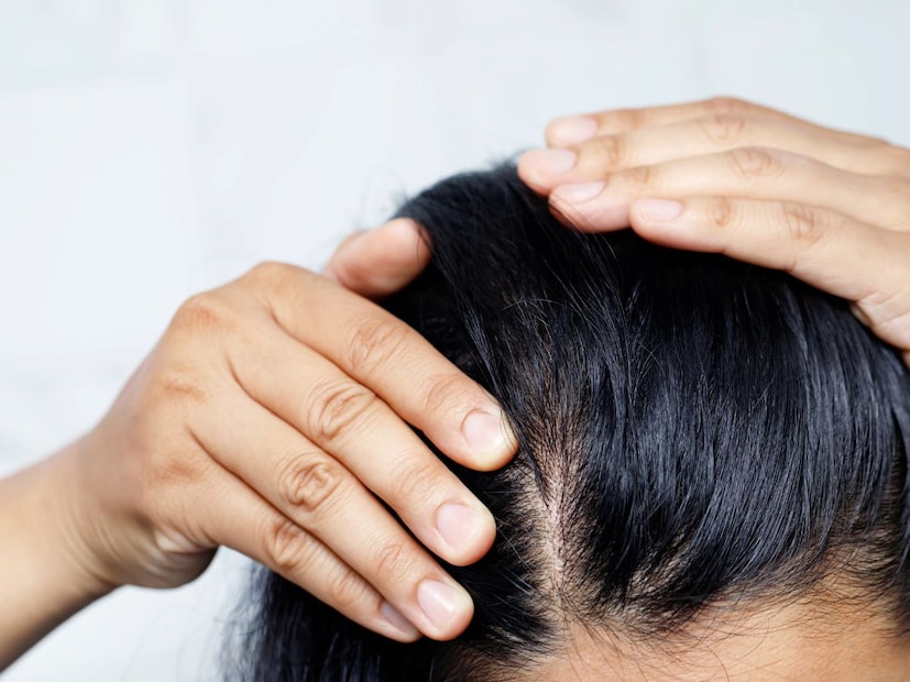 बायोटिनची कमतरता कशी भरून काढाल?बायोटिनची कमतरता टाळण्यासाठी किंवा ती भरून काढण्यासाठी आहारात काही विशिष्ट पदार्थांचा समावेश करणे अत्यंत महत्त्वाचे आहे.