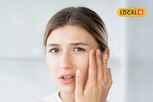 Health Tips : हिवाळ्यात त्वचा कोरडी पडते? खोबऱ्याचं नाही तर 'या' तेलाचा करा असा वापर, राहील तजेलदार!