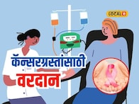 ही उपचार पद्धती ठरतेय कॅन्सरग्रस्तांसाठी वरदान, डॉक्टरांनी सांगितली सविस्तर माहिती, Video