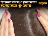 Health Tips : हिवाळ्यात केसांमध्ये होतोय कोंडा? हे उपाय लगेच करा, रहाल गंभीर आजारांपासून दूर