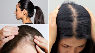 कोणत्या चुकीच्या हेअरस्टाईल्सने होते केसगळती?