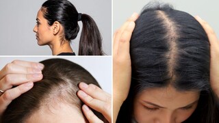 कोणत्या चुकीच्या हेअरस्टाईल्सने होते केसगळती?