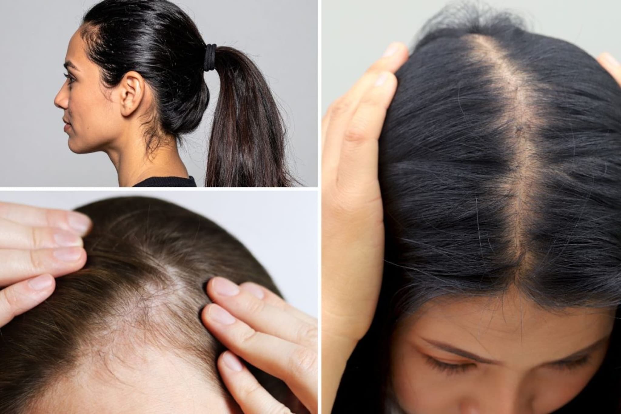 काळजी घेता तरी केसगळती होते? हेअरस्टाईल ठरतेय कारण, तज्ज्ञांनी सांगितला उपाय