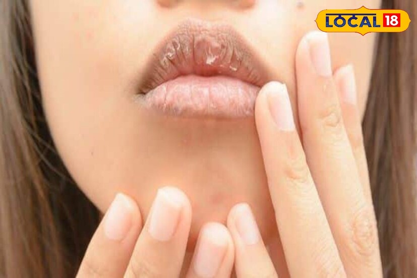 हिवाळ्यात त्वचेसाठी, केसांसाठी आणि अगदी ओठांच्या काळजीसाठी कोरफड अनेक प्रकारे वापरली जाते. ताजे कोरफडीचे जेल जळजळ कमी करते. सकाळी आणि संध्याकाळी ओठांना कोरफडीच्या जेलचा पातळ थर लावा, ज्यामुळे ते मऊ आणि सुंदर राहतील.