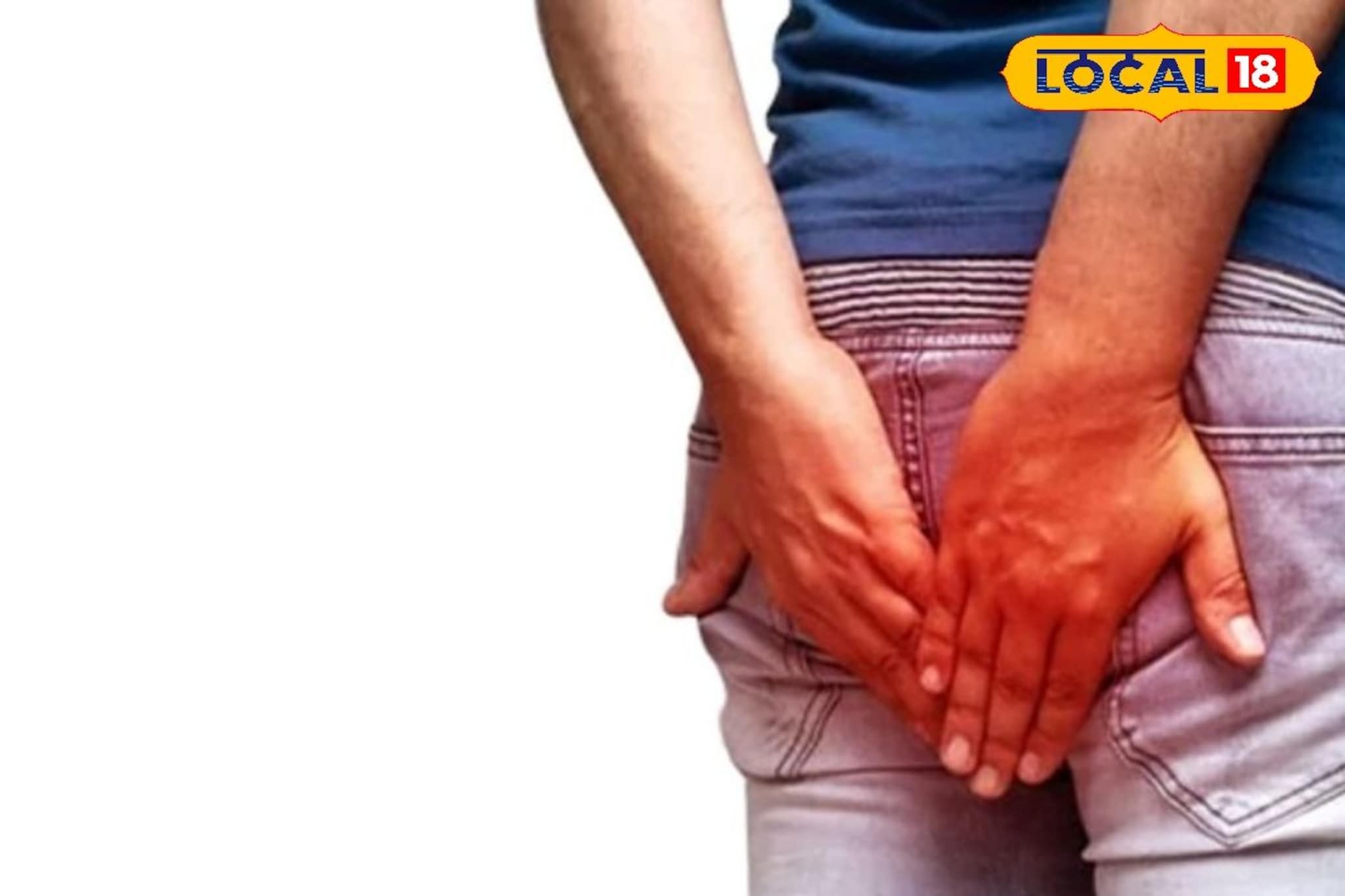 जास्त मटण, चिकन खाल्ल्यामुळे मूळव्याधा होते का? हिवाळ्यात काय टाळलं पाहिजे? जास्त मटण, चिकन खाल्ल्यामुळे मूळव्याधा होते का? हिवाळ्यात काय टाळलं पाहिजे?