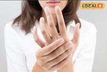 Health Tips : हिवाळ्यात तुमचे हात-पाय सुजतात का? नेमकी कोणती घ्यावी काळजी, डॉक्टरांचा महत्त्वाचा सल्ला