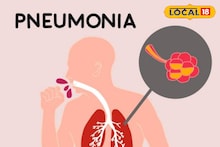 7 ते 8 दिवस खोकला राहतो, ताप येतो, पुण्यात नव्या आजाराचं थैमान, डॅाक्टरांचा अलर्ट
