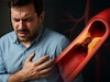 ऑफिसमधून Heart Attack घरी नेता; कुलकर्णी डॉक्टर म्हणाले, ...मग थांबत नाही अटॅक!