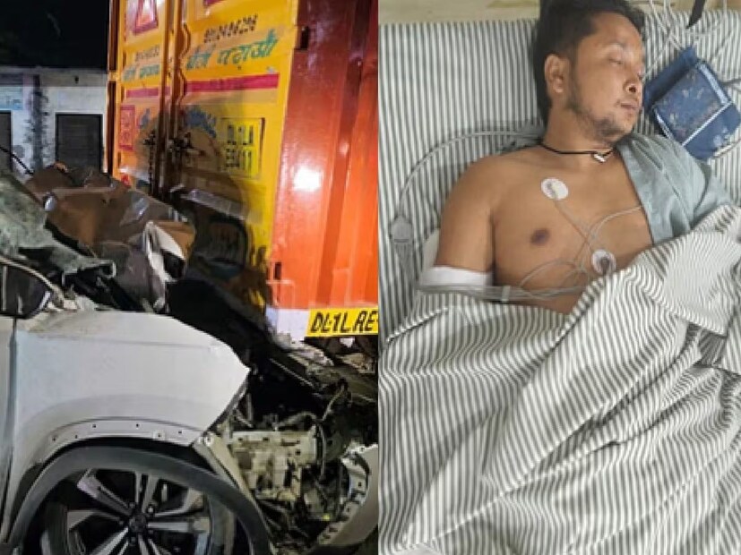  पवनदीप पुढे म्हणाला,"एक महिना मी डावीकडून उजवीकडेही वळू शकत नव्हतो. आता मी थोडंफार चालू शकतो, त्यामुळे मला खूप आनंद होतो. त्या काळाने मला चालण्याचं महत्त्व शिकवलं. एखादी घटना घडली की तिच्यातून लवकर बाहेर यायला हवं. आनंदी राहा आणि तिला जीवनाचा एक भाग समजा. मला हे सहन करावं लागलं. आता मी थोडंसं चालू लागलो आहे आणि कदाचित महिनाभरात सगळं ठीक होईल".