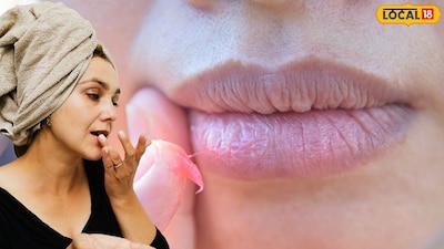 हिवाळा येताच ओठ फाटणे सामान्य होते. काही सोप्या घरगुती घटकांमुळे ओठ मऊ राहण्यास मदत होऊ शकते. झोपण्यापूर्वी ओठांवर मध आणि ग्लिसरीनचे 2-3 थेंब मिसळून लावा. यामुळे ओठांना बराच काळ मॉइश्चराइझ राहण्यास मदत होईल आणि ते लवकर बरे आणि मऊ होण्यास मदत होईल.