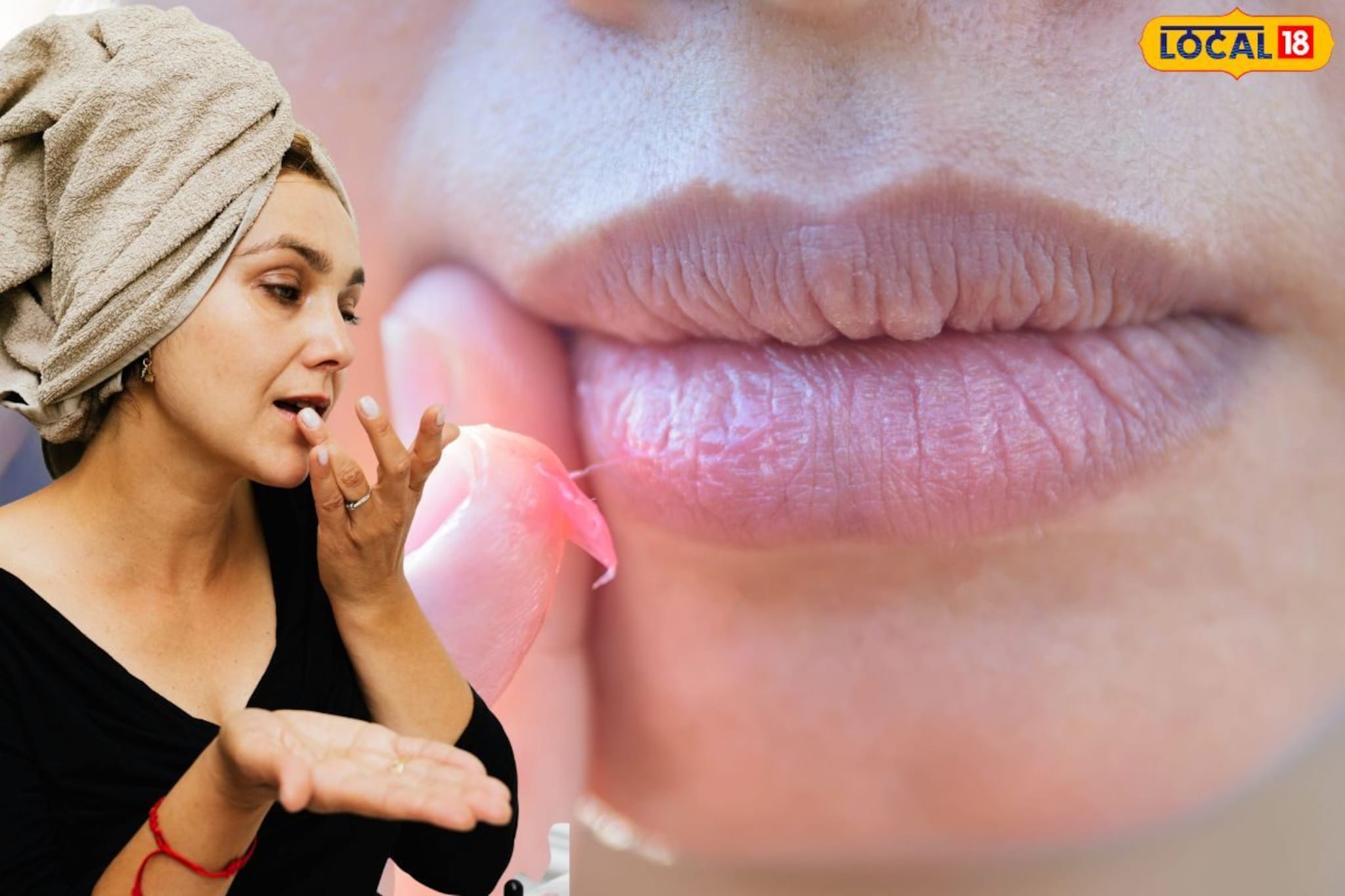 हिवाळ्यात ओठ फाटण्याचा त्रास वाढतोय? 'हे' सोपे उपाय करा, ओठ कायम राहतील मऊ!