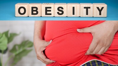 Obesity Risks Uncovered: Mumbai Experts Reveal Link to Diabetes, Heart Disease, Cancer, Liver Issues