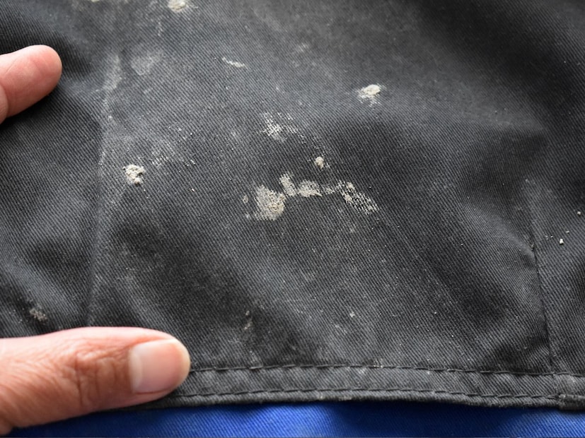 Disclaimer : या बातमीत दिलेली माहिती आणि आरोग्याशी संबंधित सल्ला तज्ञांशी झालेल्या संभाषणांवर आधारित आहे. ही सामान्य माहिती आहे, वैयक्तिक सल्ला नाही. म्हणून, डॉक्टरांचा सल्ला घेतल्यानंतरच काहीही वापरा. त्याच्या वापरामुळे होणाऱ्या कोणत्याही नुकसानासाठी न्यूज-18 जबाबदार राहणार नाही. 