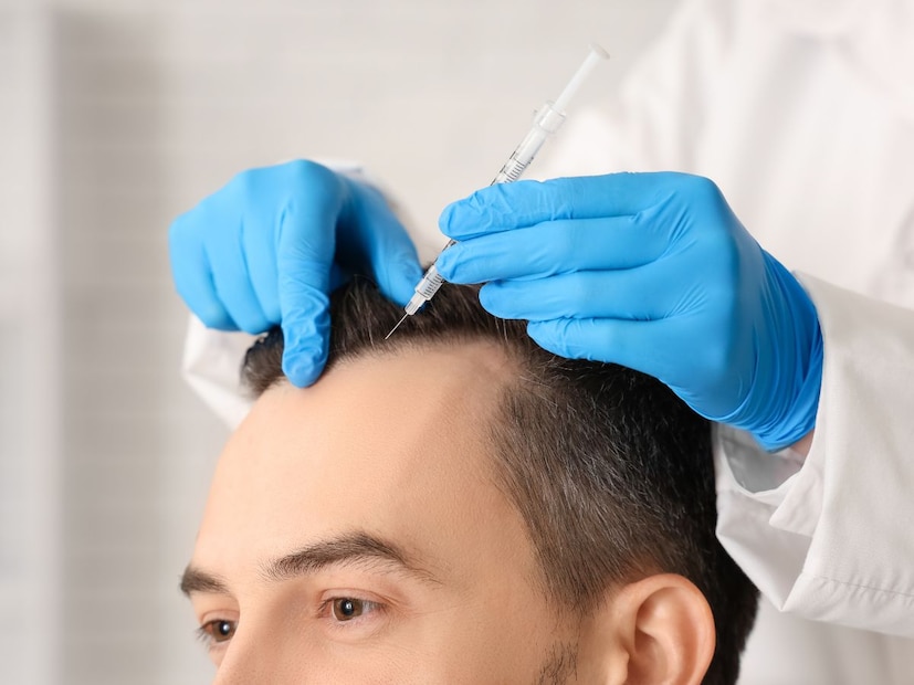 Disclaimer : या बातमीत दिलेली माहिती आणि आरोग्याशी संबंधित सल्ला तज्ञांशी झालेल्या संभाषणांवर आधारित आहे. ही सामान्य माहिती आहे, वैयक्तिक सल्ला नाही. म्हणून, डॉक्टरांचा सल्ला घेतल्यानंतरच काहीही वापरा. त्याच्या वापरामुळे होणाऱ्या कोणत्याही नुकसानासाठी न्यूज-18 जबाबदार राहणार नाही. 