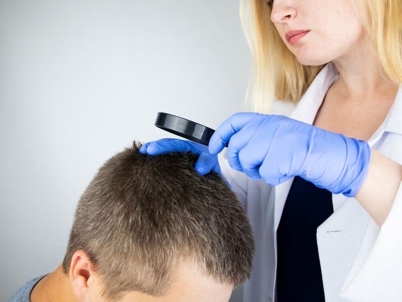 जेव्हा एखादी व्यक्ती चुकीच्या ठिकाणी हेअर ट्रान्सप्लांट करून घेते, तेव्हा तिला केवळ तात्पुरता त्रास होत नाही, तर त्या त्रासातून बाहेर पडण्यासाठी तिला लांब आणि महागडे उपचार घ्यावे लागतात. संसर्ग बरा करण्यासाठी अँटिबायोटिक्स, जखमा भरून काढण्यासाठी विशेष मलमे आणि खराब झालेले केस पुन्हा व्यवस्थित करण्यासाठी दुरुस्ती शस्त्रक्रिया करावी लागते. हे सर्व रुग्णाला मोठा आर्थिक फटका आणि मानसिक ताण देतात. तसेच उपचाराचा काळही वाढतो.