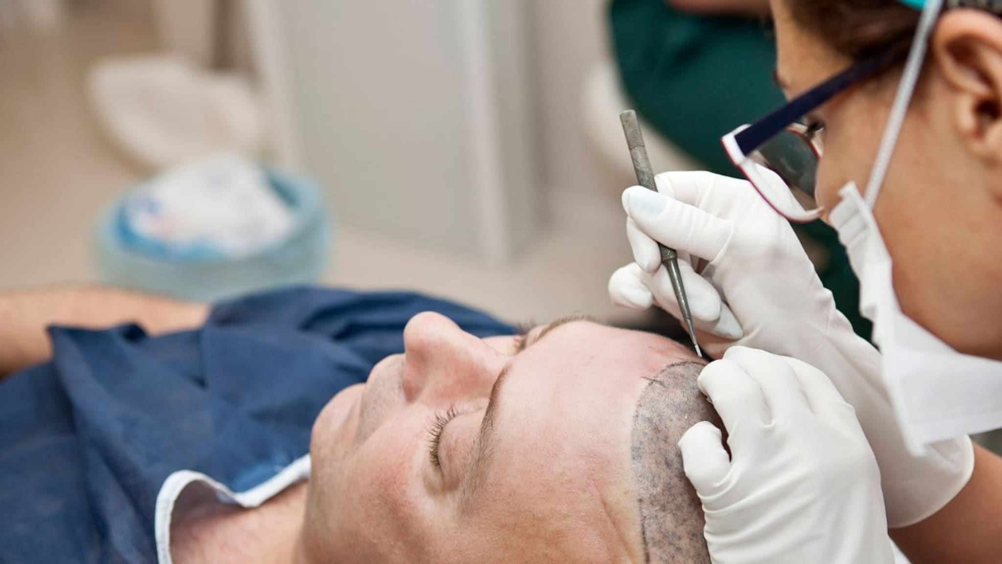 Hair Transplant Risks : हेअर ट्रांसप्लांट करताय? सावधान.. जीवावर बेतू शकते प्रक्रिया, हे दुष्परिणाम माहित हवेच