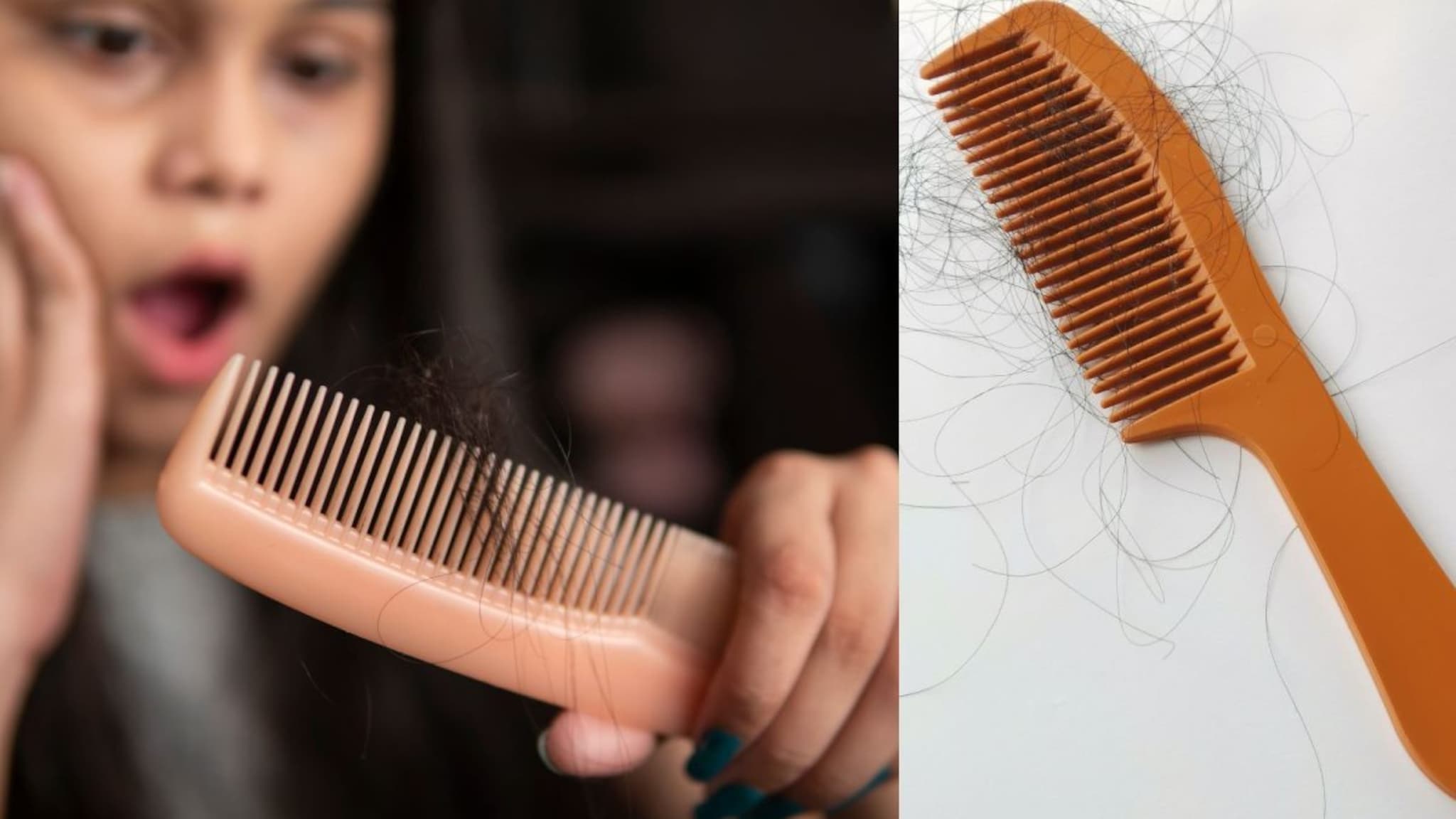 Hair Fall : हिवाळ्यात केस गळण्याचं प्रमाण का वाढतं ? जाणून घ्या कारणं, घरगुती उपाय करुन पाहा