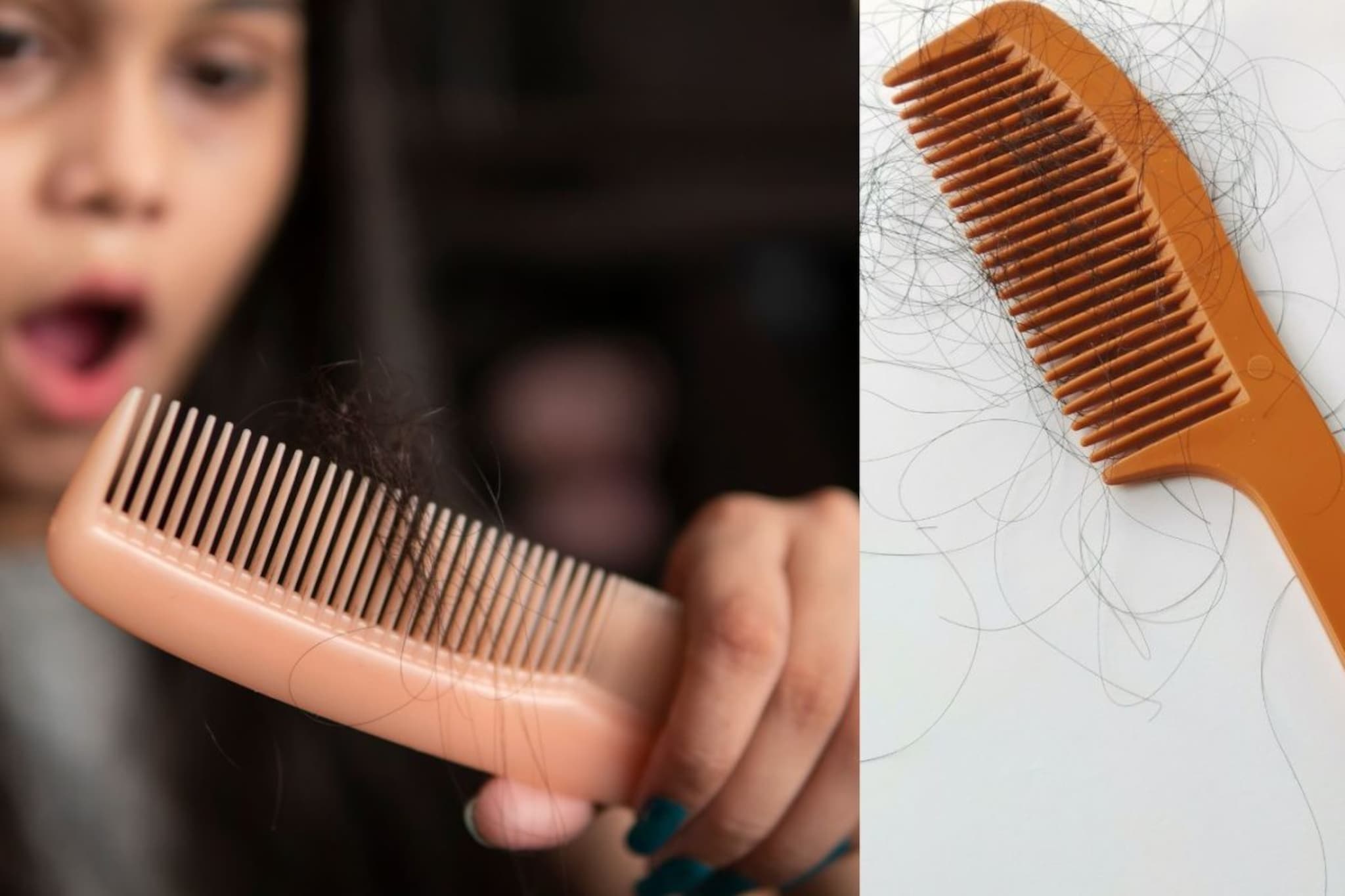 Hair Fall : हिवाळ्यात केस का गळतात ? केस गळती रोखण्यासाठी काय करावं ? Hair Fall : हिवाळ्यात केस का गळतात ? केस गळती रोखण्यासाठी काय करावं ?