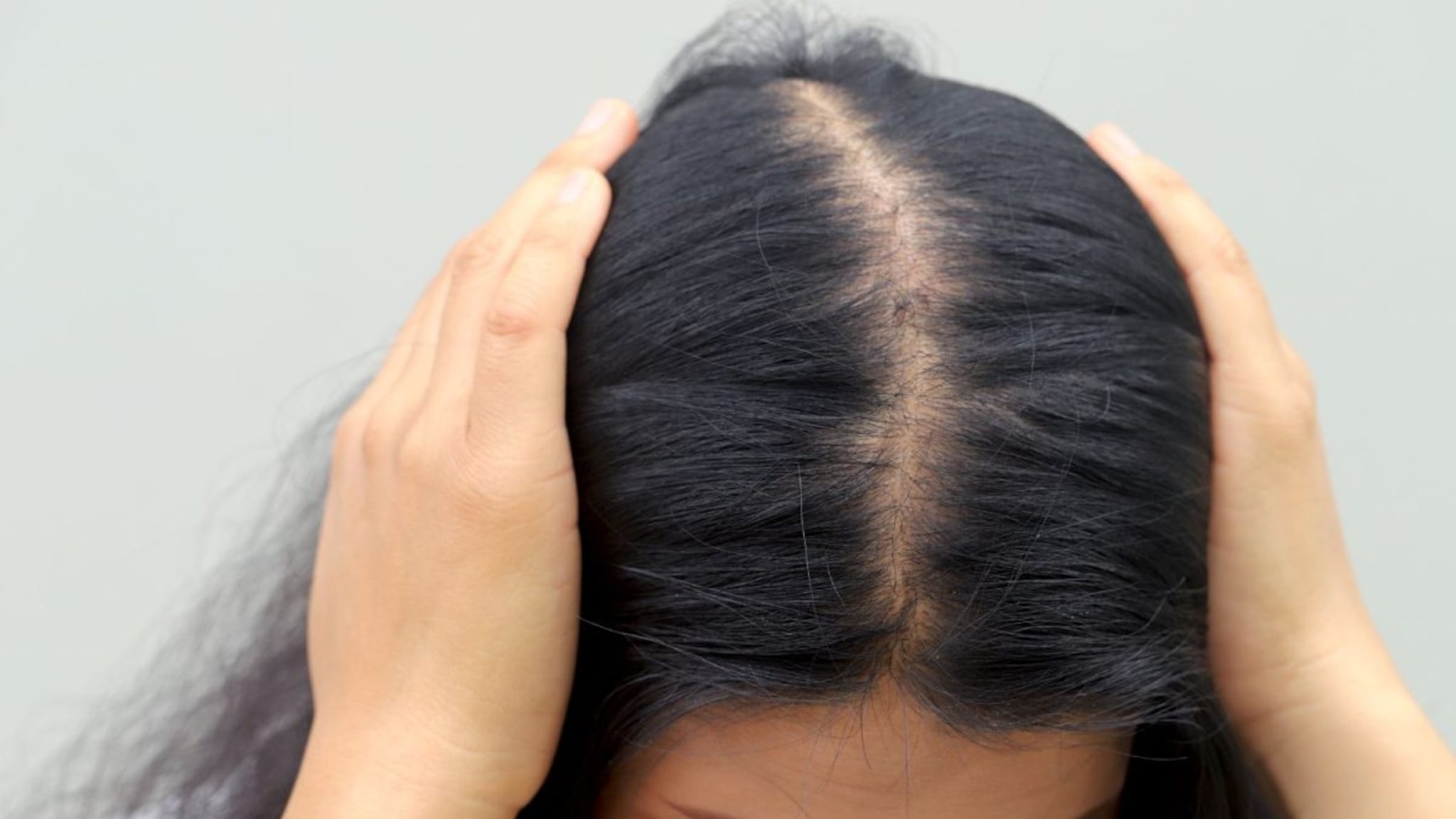 Hair Care : केस गळती थांबवण्यासाठी उपाय, तेलांबरोबरच पौष्टिक आहाराकडेही लक्ष देणं महत्त्वाचं