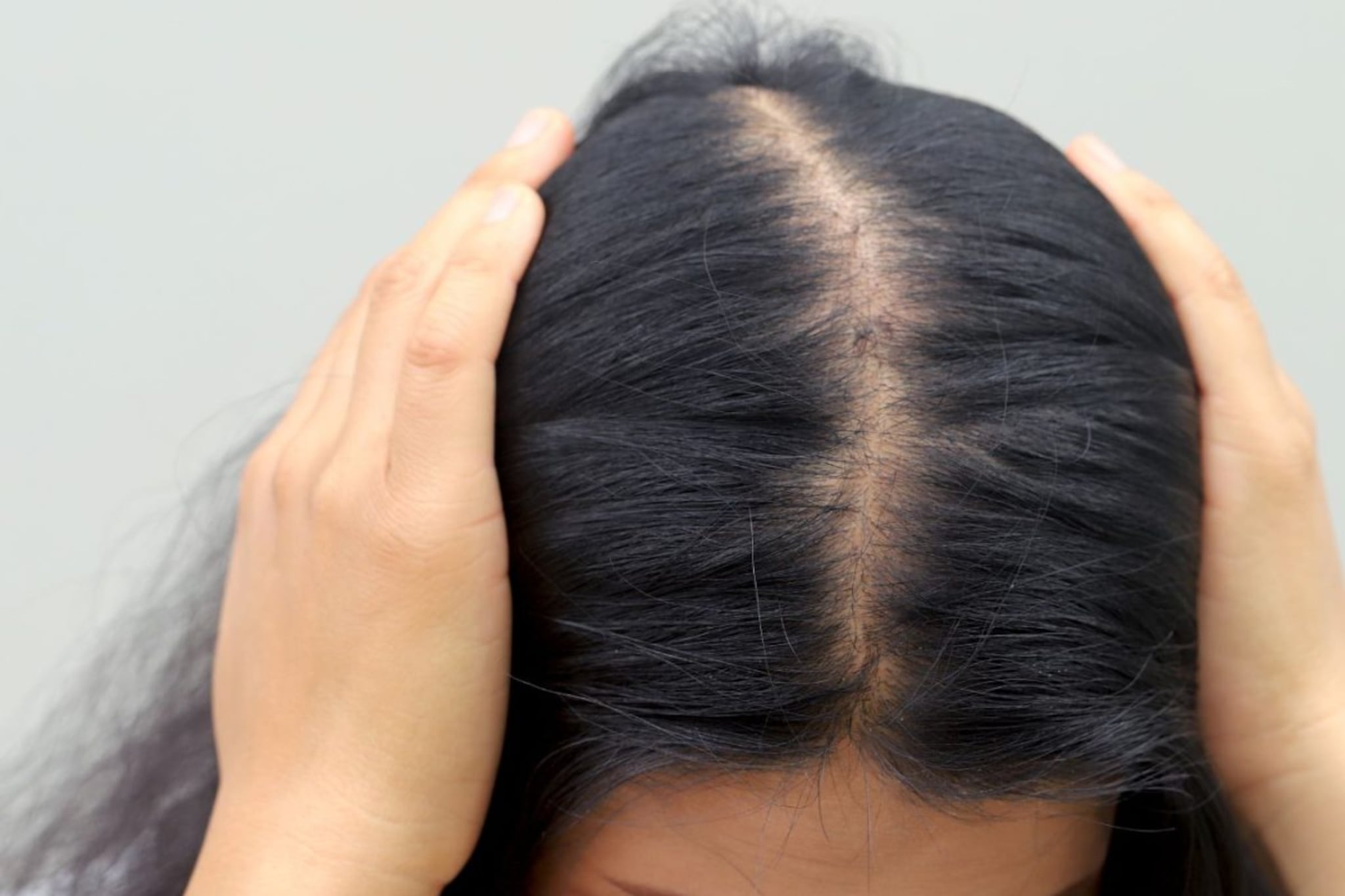 Hair Care : केसांच्या पोषणासाठी कोणता आहार महत्त्वाचा ? या पदार्थांचा करा समावेश Hair Care : केसांच्या पोषणासाठी कोणता आहार महत्त्वाचा ? या पदार्थांचा करा समावेश