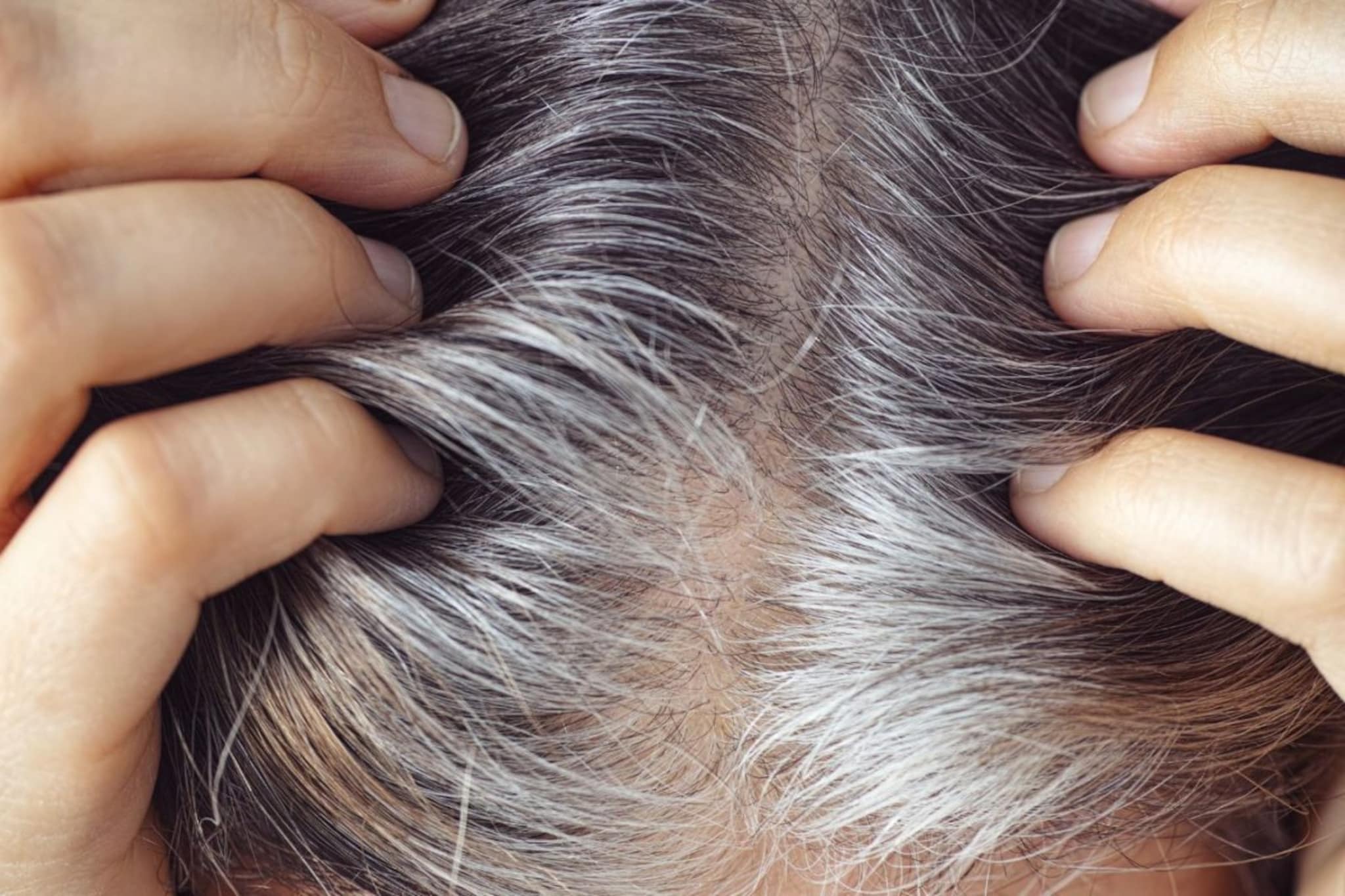 Grey Hair : केस अकाली पांढरे होण्याचं कारण काय ? कमी वयात केस पांढरे का होतात ? Grey Hair : केस अकाली पांढरे होण्याचं कारण काय ? कमी वयात केस पांढरे का होतात ?