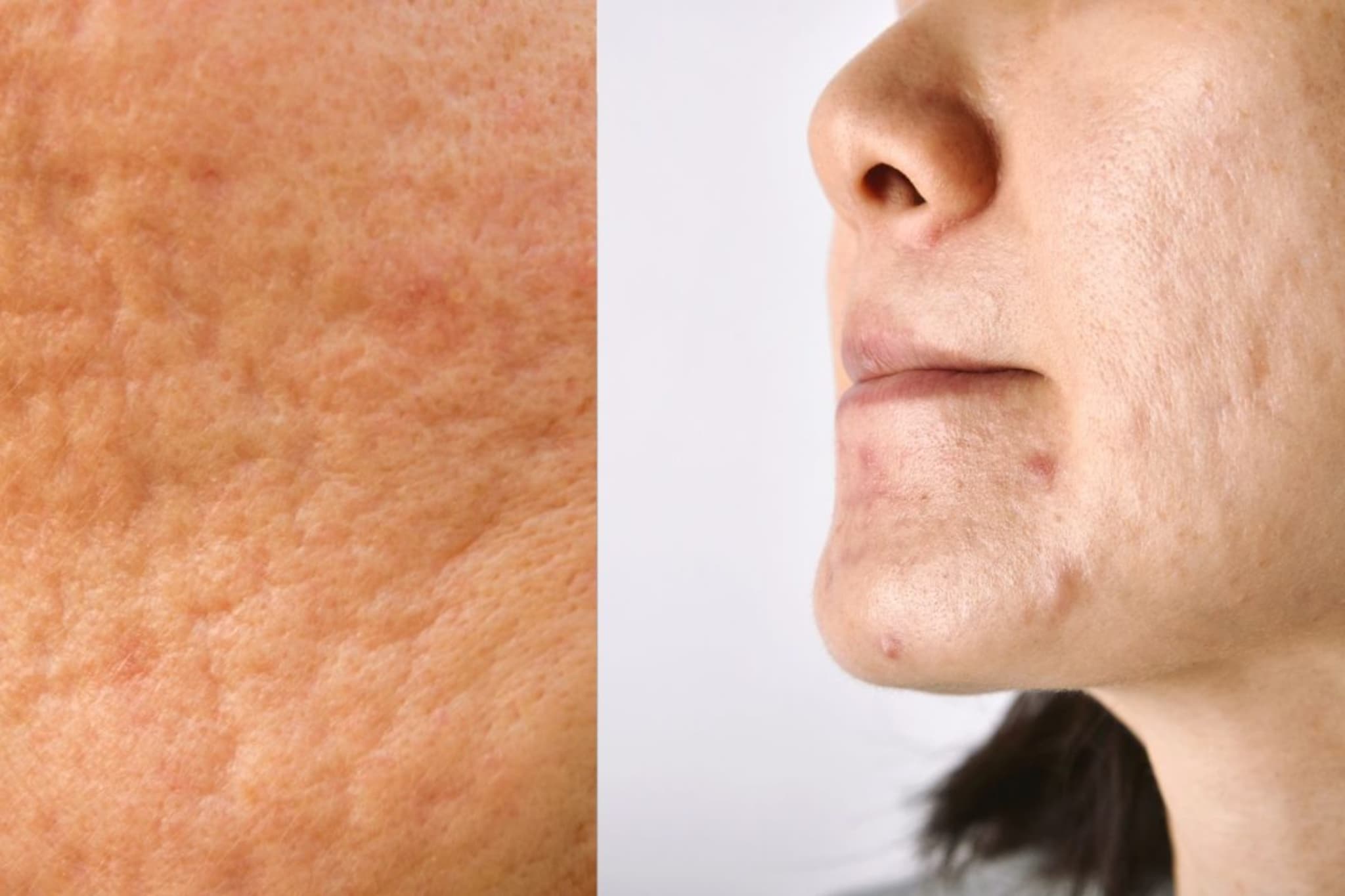 Skin Care : चेहऱ्यावरचे डाग घालवण्यासाठी आवश्यक टिप्स, नक्की वापरुन पाहा Skin Care : चेहऱ्यावरचे डाग घालवण्यासाठी आवश्यक टिप्स, नक्की वापरुन पाहा