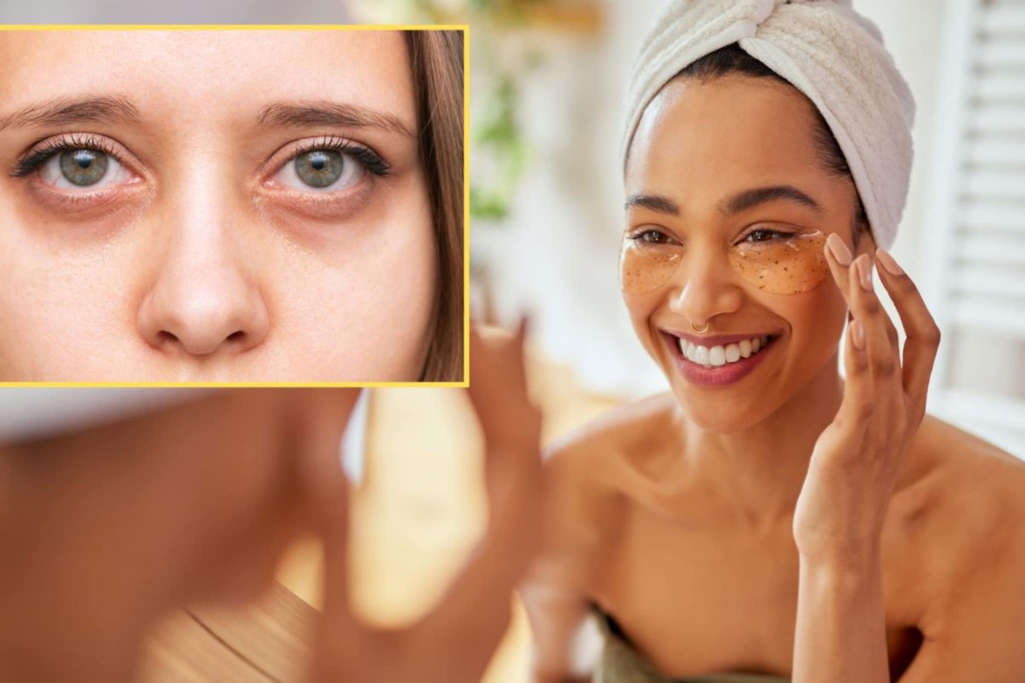 रात्रीच्या वेळी लावा 'हा' घरगुती मास्क, फक्त 3 दिवसांत गायब होतील डार्क सर्कल!