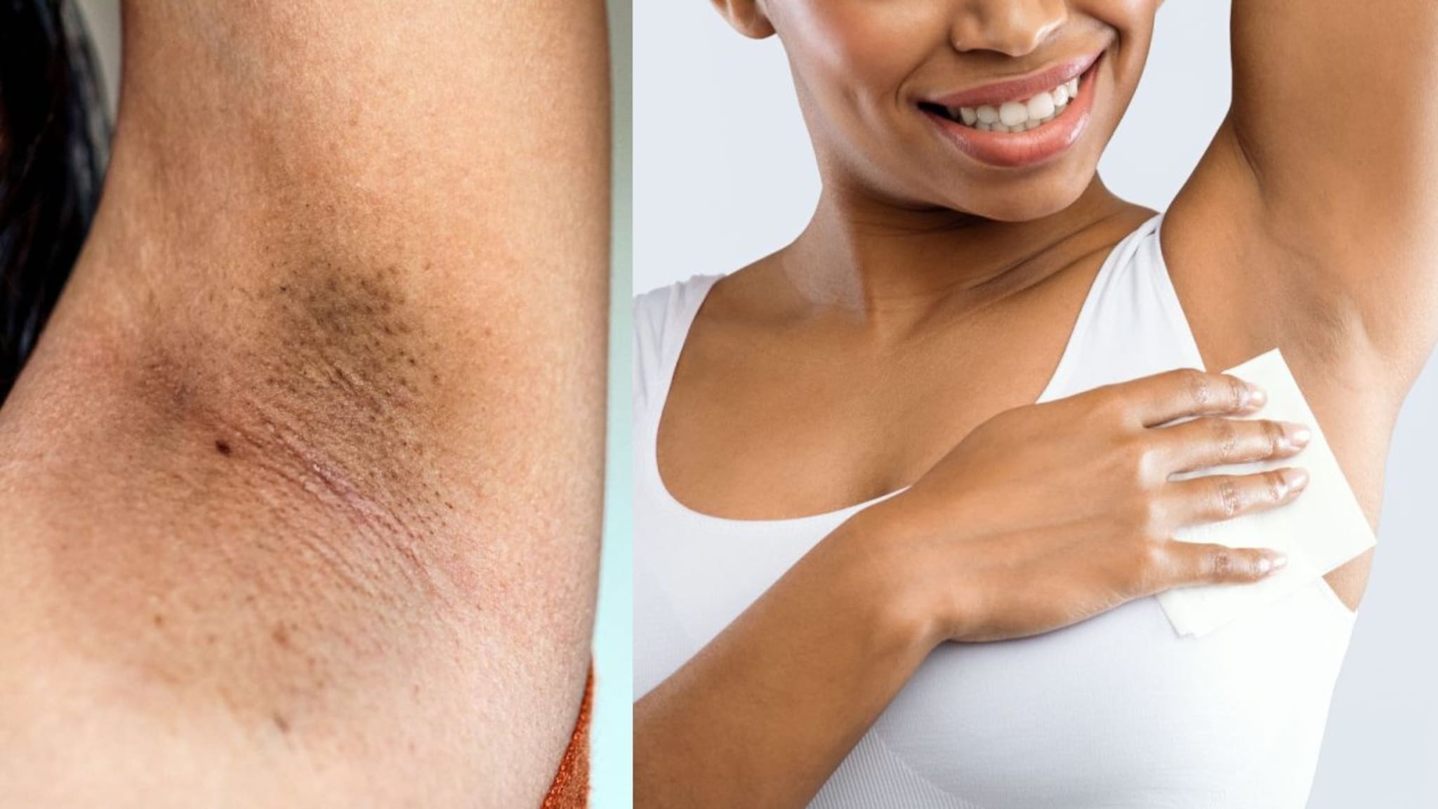 Underarms : काखेतल्या काळेपणावर करा मात, या इलाजानं त्वचा होईल स्वच्छ, काळे डाग होतील कमी