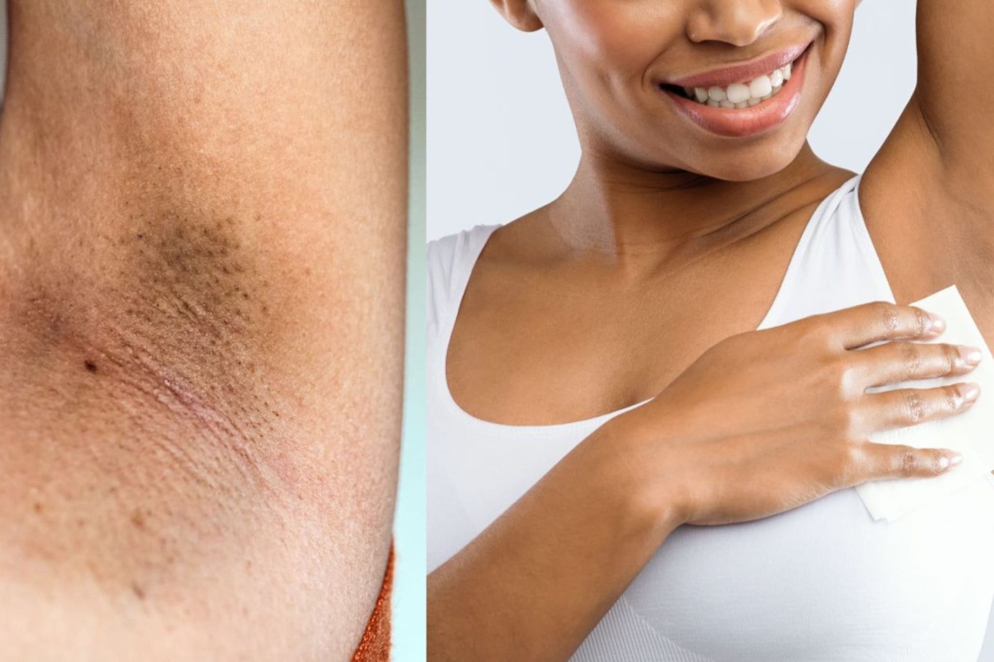 Underarms : काळ्या काखांवर उपाय, त्वचारोगतज्ज्ञांनी सांगितलेला इलाज करुन पाहा