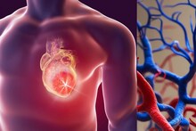 Heart Disease : कोरोनरी आर्टरी डिसीज म्हणजे काय ? हृदयासाठी ही व्याधी का ठरते घातक ?