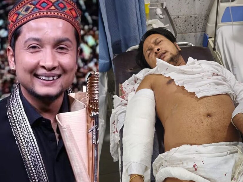  पवनदीपचा अपघात झाल्यानंतर चाहत्यांकडून चिंता व्यक्त केली जात होती. त्याच्या कारची ट्रकला धडक लागली त्यावेळी तो त्याच कारमध्ये झोपलेला होता. धडक लागल्यानंतर त्याची कार पेटली. त्यावेळी त्याला गाडीतून हलताही येत नव्हतं. कारला आग लागल्यानंतरही तेव्हा त्याच्या मदतीला कोणी येत नव्हतं. नंतर पोलिसांनी त्याला बाहेर काढलं.